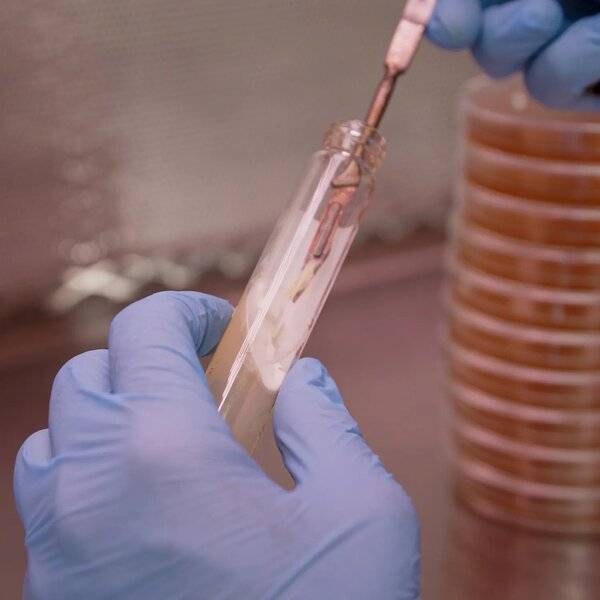 Mycology Lab Skills: Plates, Slants, & Liquid Culture